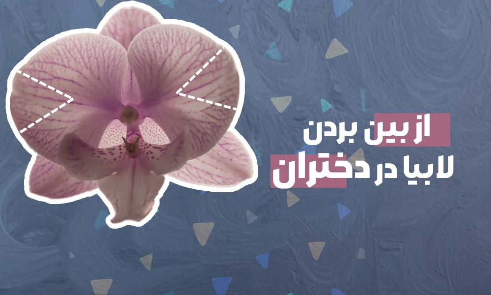 از بین بردن لابیا؛ کوچک سازی لابیاهای بزرگ و دچار افتادگی
